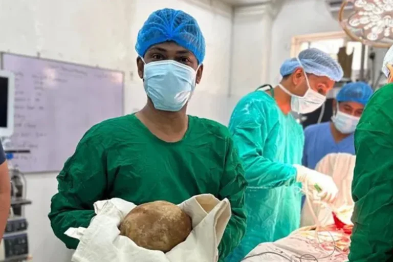 মূত্রনালী থেকে বের করা হল ৩.১ কেজি ওজনের পাথর