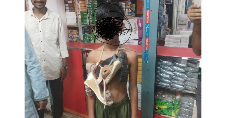 চুরির অভিযোগে শিশুর গলায় জুতারমালা!